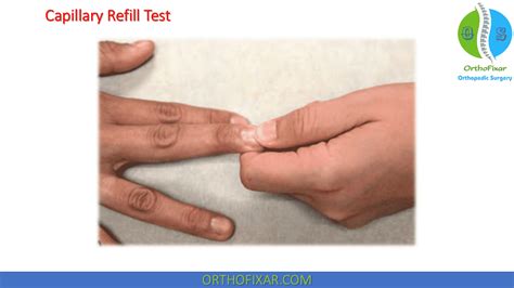 testing capillary refill on thick nail|how to assess capillary refill.